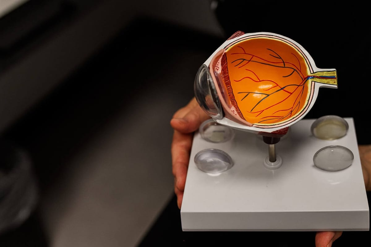 An anatomical model of the eye and a tray of trial lenses held out on a stand at West 5 Optometry